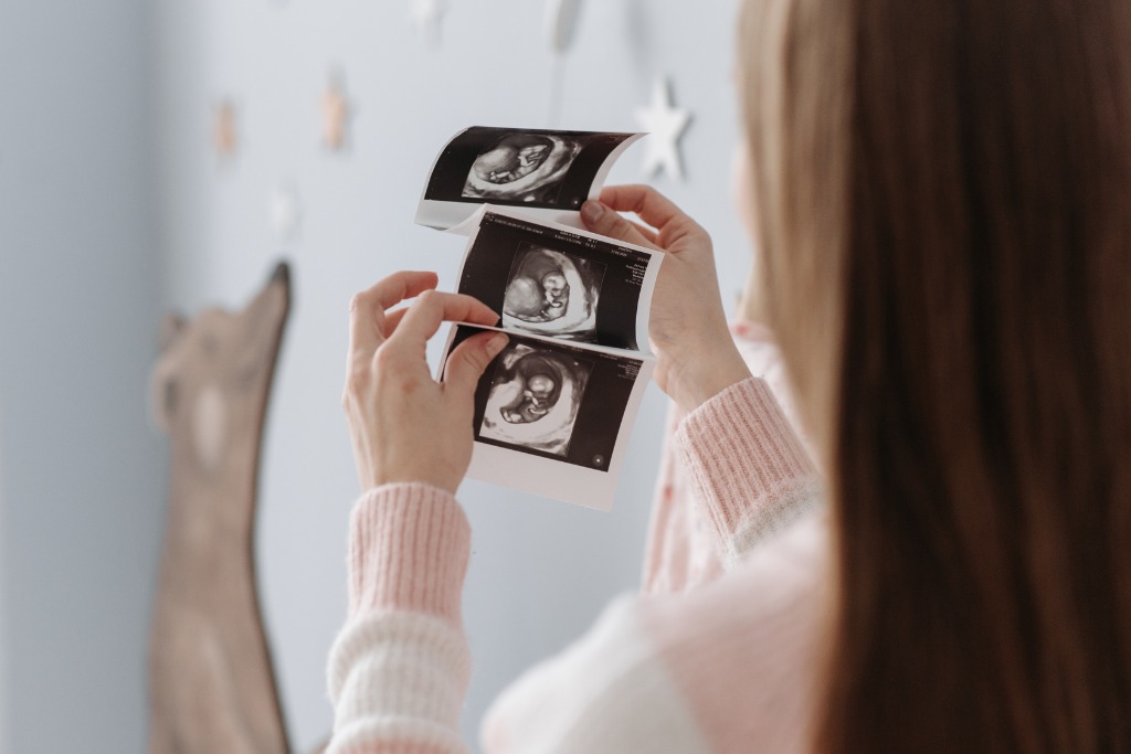 A woman is looking at the ultrasound scan of the baby